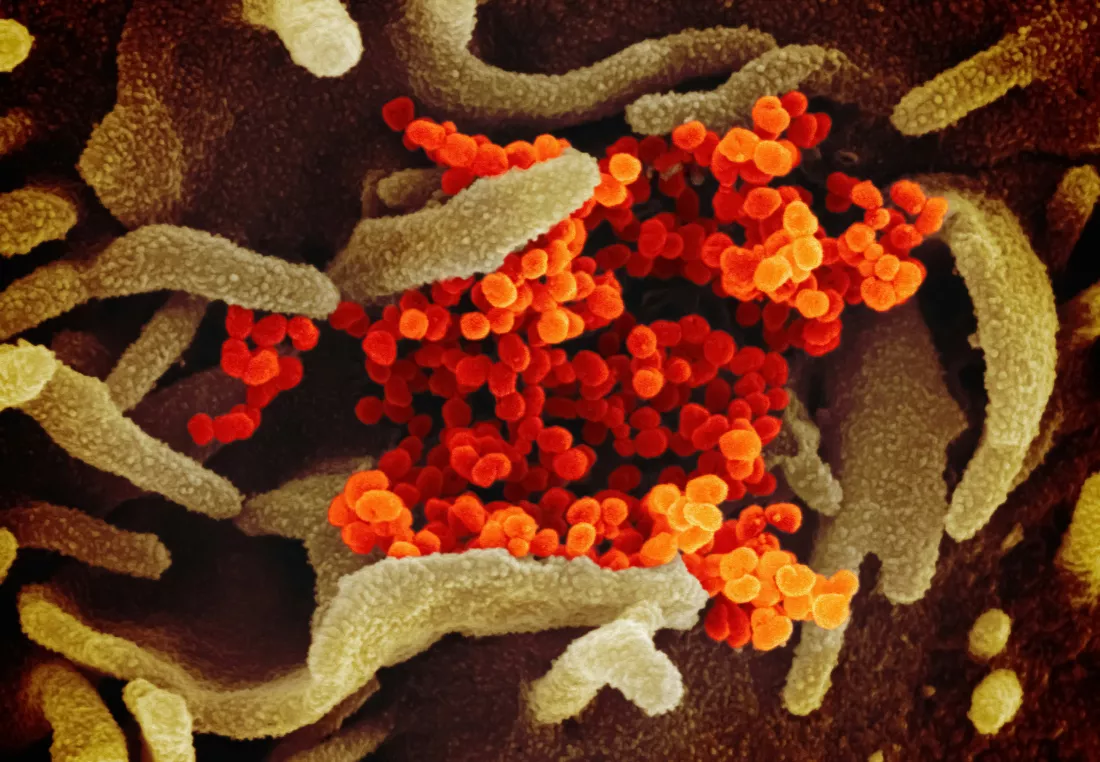 national-institute-of-allergy-and-infectious-diseases-g8Xhd1wmDa8-unsplash